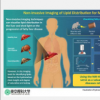 新研究推出机器学习辅助非侵入性成像用于快速肝脏脂肪可视化