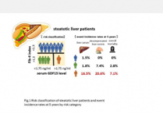 脂肪肝患者新型生物标志物GDF15水平高与肝癌风险增加有关