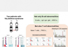 揭示18q染色体缺失综合征的晚发性联合免疫缺陷
