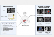 肝细胞癌的超声检查从诊断到预后