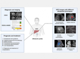 肝细胞癌的超声检查从诊断到预后